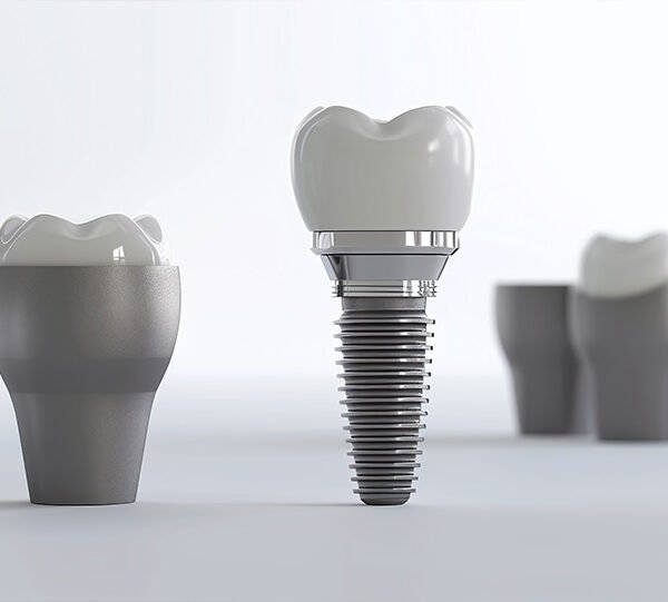Implant Tedavisi