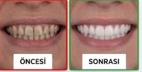 Öncesi / Sonrası 7